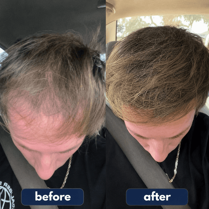 PuraHair - Hair Growth Serum