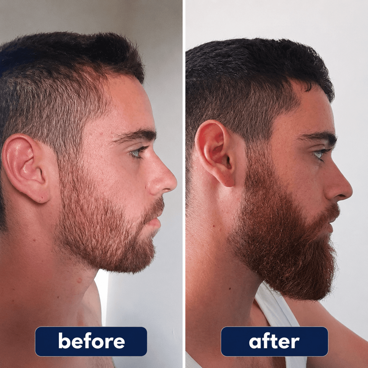 PuraHair - Hair Growth Serum