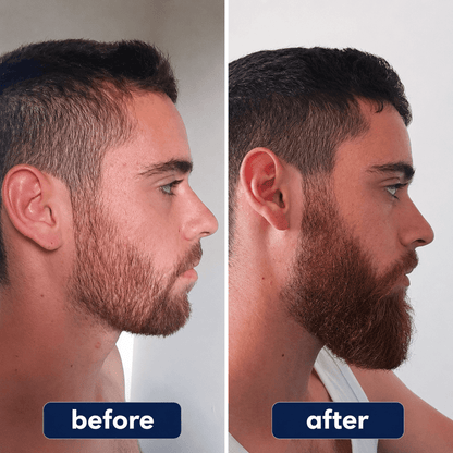 PuraHair - Hair Growth Serum